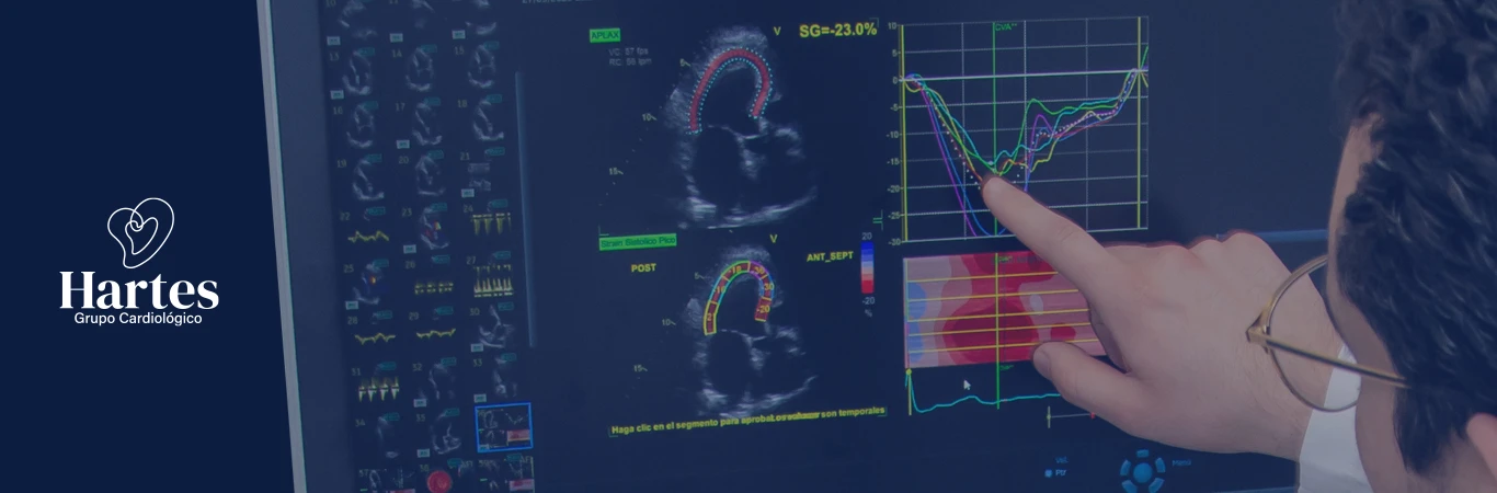 Imagen destacada del post ¿Qué es un ecocardiograma de estrés?