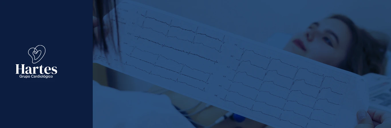 Imagen destacada del post Enfermedades cardiovasculares en la mujer